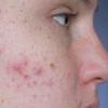 homeopathic medicines Online