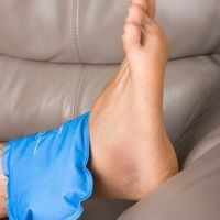 ankle-sprain