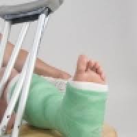 Broken Bones/Fractures